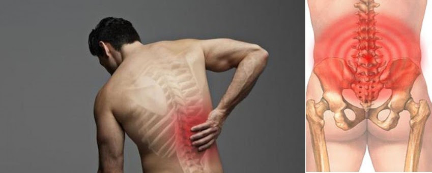 Bệnh đau cột sống lưng ở nam giới: Nguyên nhân và cách điều trị hiệu quả